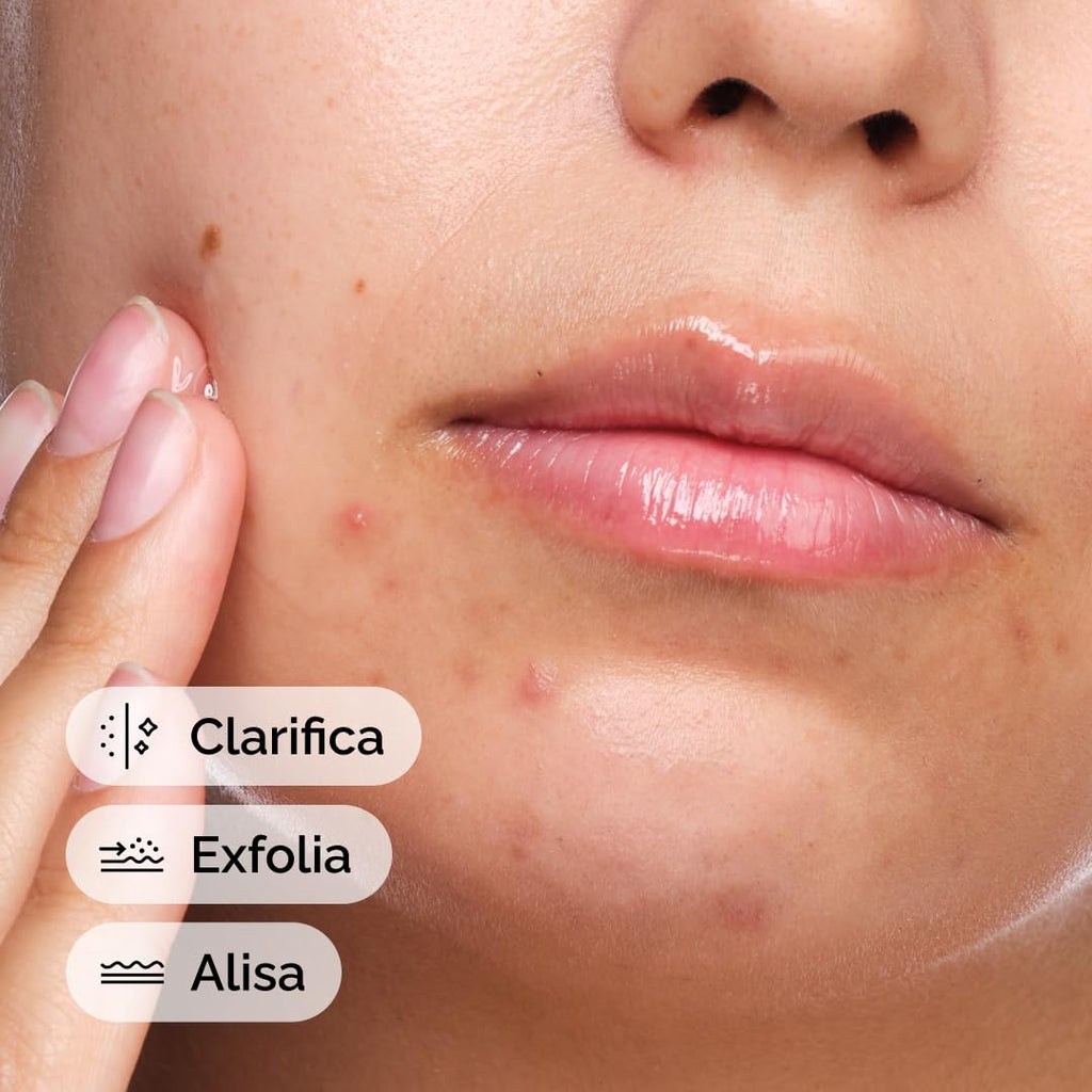 The Ordinary Salicylic Acid 2% Solution, Serum with Salicylic Acid, Specific Serum for Skin Prone to Blemishes, 30 ml