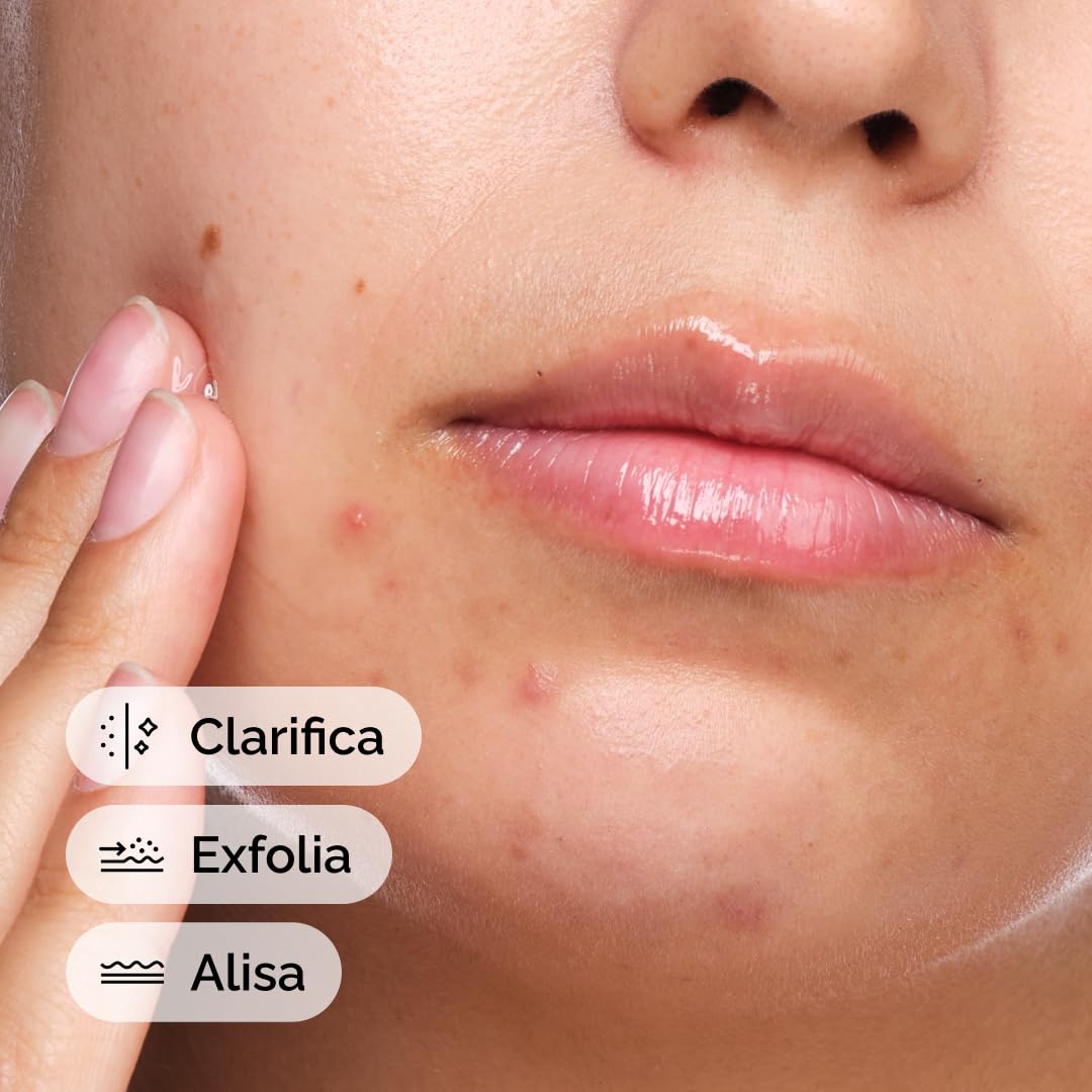 The Ordinary Salicylic Acid 2% Solution, Serum with Salicylic Acid, Specific Serum for Skin Prone to Blemishes, 30 ml